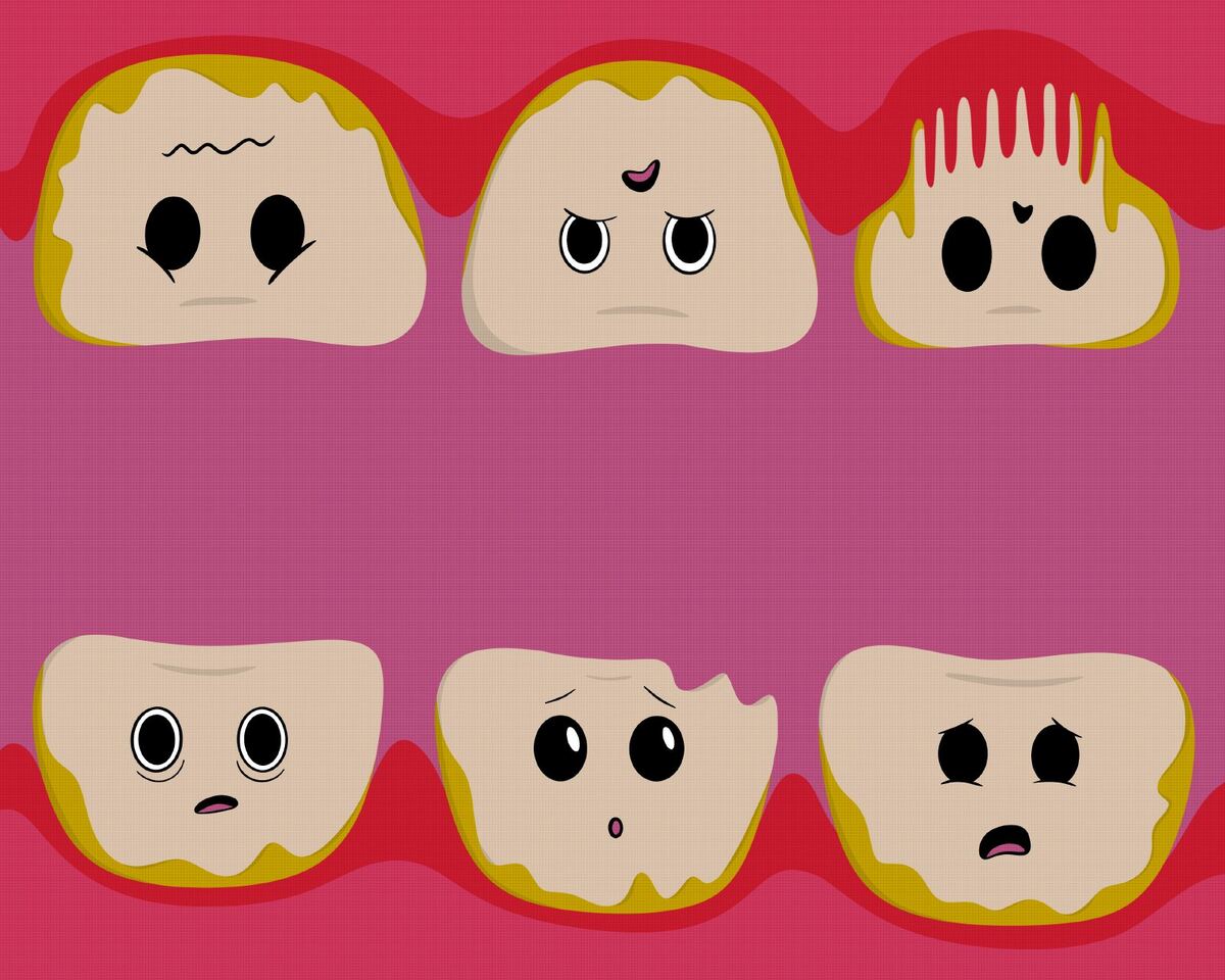 Yellowed, cracked teeth with worried faces.